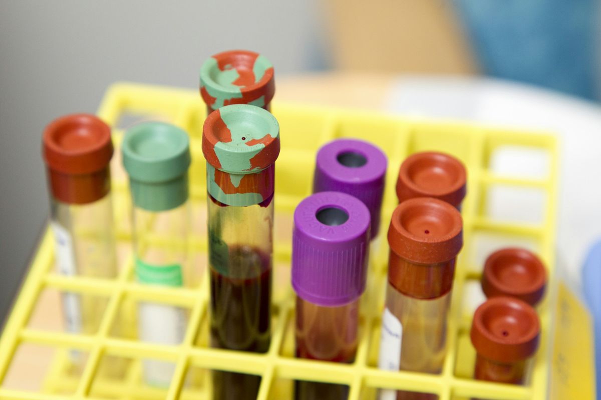 Provetorroer i stativ pa laboratorium
